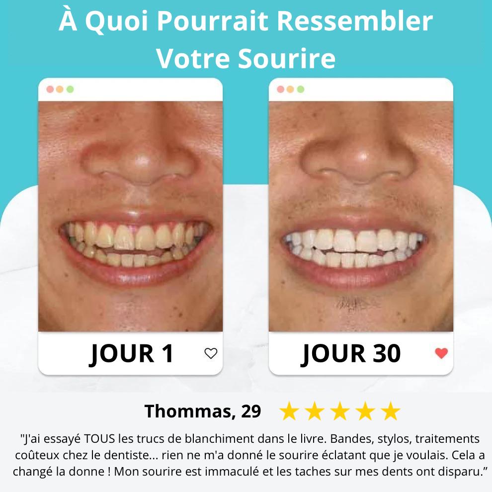 Brosse à dents électrique