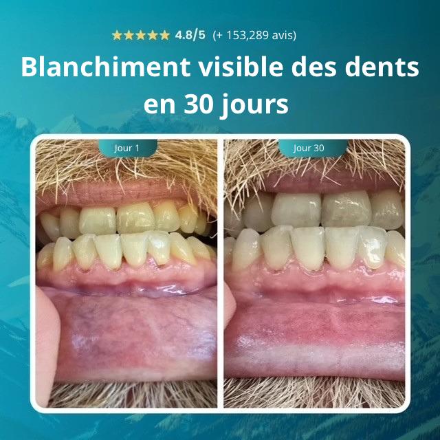 Gomme reminéralisante